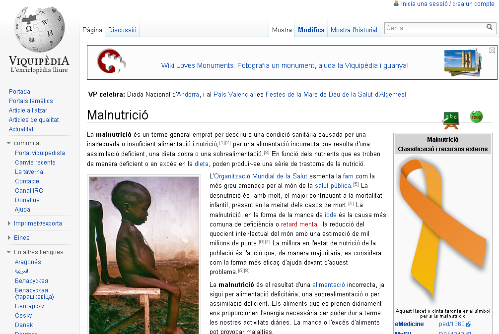 Malnutrició | Recurso educativo 43366