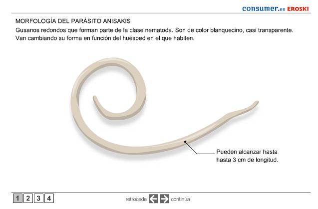 ¿Cómo defenderte del anisakis? | Recurso educativo 46997