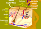 Immune system | Recurso educativo 52752